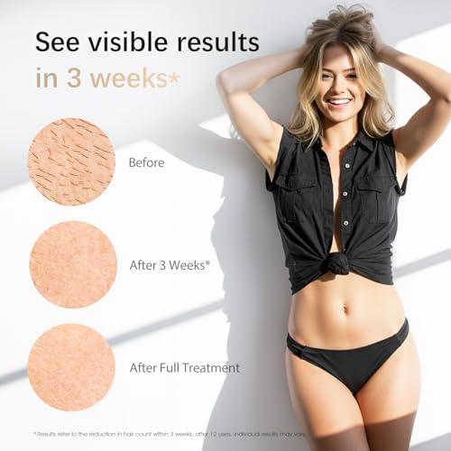 Miniatura de Depiladora Láser IPL en Casa con Refrigeración 45°F - Indolora y Duradera 3