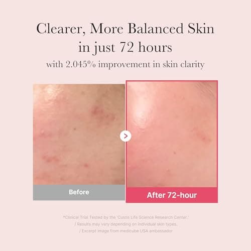 medicube TXA+Niacinamide 15% Glow Facial Serum for After Spot Care | All-in-One Daily Korean Skincare | Uneven Skin Tone, Texture, and Hydration Care | High-Potency Tranexamic Acid thumbnail 3