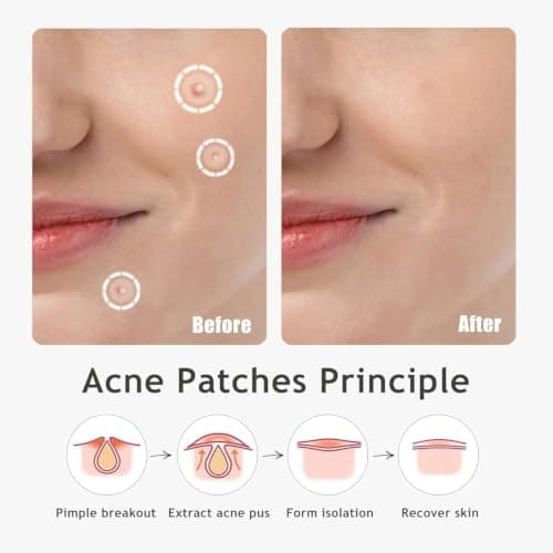 Dazzlook Ultra Pimple Patches, Invisible Patch, Salicylic Acid, 120 Count thumbnail 5