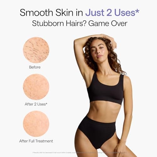 Ulike Laser Hair Removal Device Air 10 Ipl Gift for Women and Men, Ice cool and Permanent hair Reduction for Nearly Painless, Dual Lights, Skin Sensor & USHR Mode Hair Removal in 1 thumbnail 4