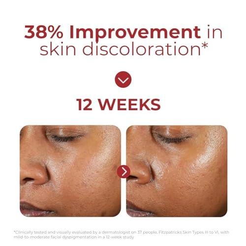 EltaMD UV Clear Deep Tinted Face Sunscreen, Oil-Free Face Moisturizer with SPF 46, Dermatology Tinted Moisturizer, Facial Travel Size Sunscreen with Zinc Oxide, 1.7 oz Pump thumbnail 4