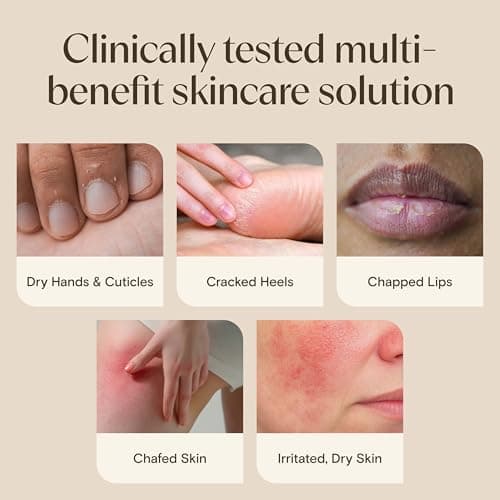 Ungüento Curativo Aveeno Skin Relief: Piel Extra Seca y Agrietada, Avena Triple y Karité, Tamaño Viaje