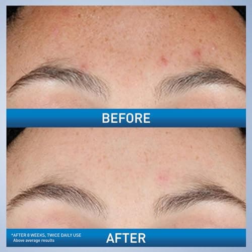 CeraVe Resurfacing Retinol Face Serum with Niacinamide, Pore Minimizer, 1oz | Skin Care Brightening Serum with Licorice Root, Acne Scar & Hyperpigmentation Treatment, Dark Spot Corrector, Skin Repair thumbnail 3