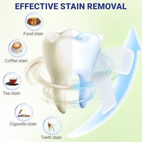 14Day Teeth Whitening Strips Kit,28 Strips (14 Treatments),Non-Slip Enamel-Safe Strips for Whiter Teeth (1 Count (Pack of 14)) thumbnail 5