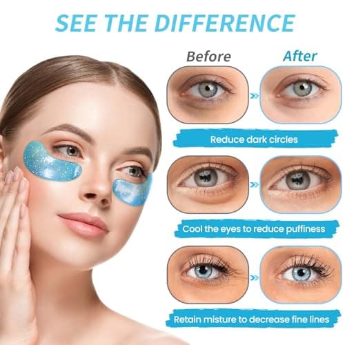Onespring Eye Masks, Under Eye Patches for Puffiness, Retinol Collagen Eye Gel Pads, Reduce Wrinkles, Eye Bags & Dark circles - Face Mask Skincare, Anti Aging & Moisturizer, 24 Pai thumbnail 2