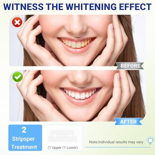 14Day Teeth Whitening Strips Kit,28 Strips (14 Treatments),Non-Slip Enamel-Safe Strips for Whiter Teeth (1 Count (Pack of 14)) thumbnail 3