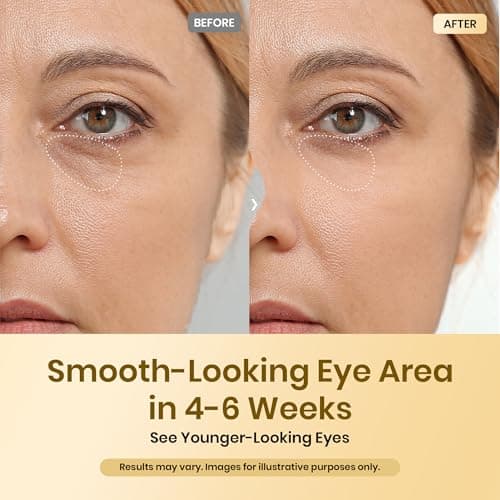 Beetles Caffeine Eye Cream with Retinol, Blur & Glow Under Eye Cream thumbnail 4