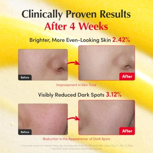 EQQUALBERRY Vitamin Illuminating Serum | Niacinamide 4% & TXA | Brightening Vitamin C Serum for Face Glow with Hyaluronic Acid | Dark Spot & Uneven Tone Care | Korean Skincare, 1.0 thumbnail 4